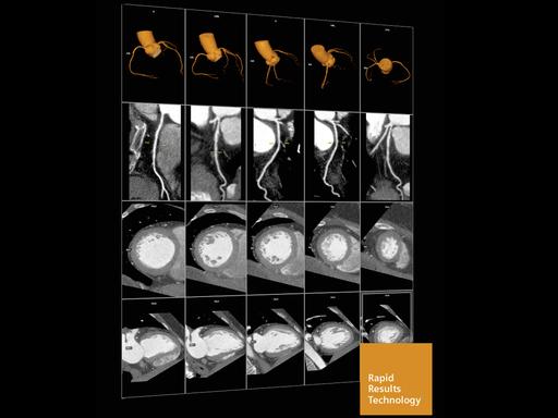 Cardiology Solutions - Siemens Healthineers USA