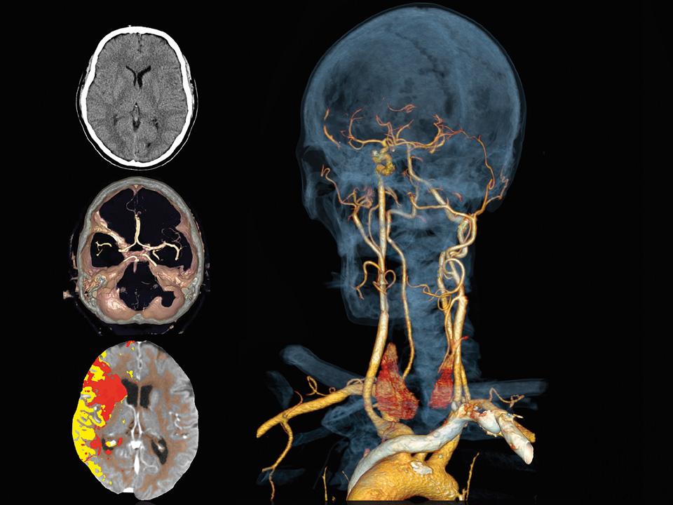 Computed Tomography Scanner &ndash; Clinical Engines - Neurology