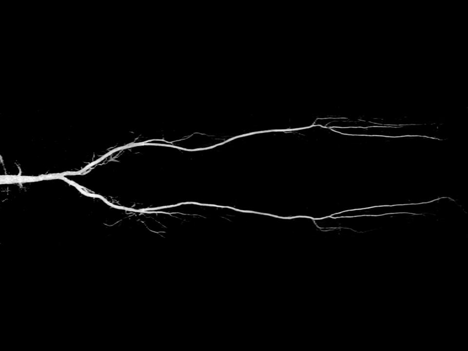 Siemens - MRI - MAGNETOM Skyra - Image - Angiography