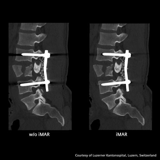 iMAR - Siemens Healthineers