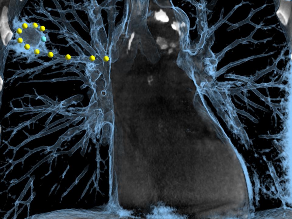 Siemens - Advanced Therapies - Study Protocols.