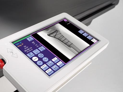 Mobile C-arm machine - Cios Fusion - Siemens Healthineers Canada