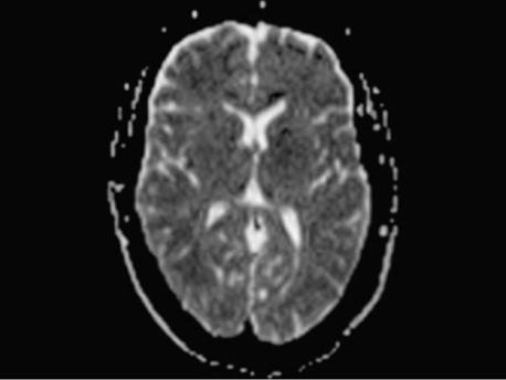 syngo.via for MRI