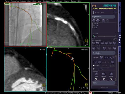 syngo CTO Guidance - Siemens Healthineers