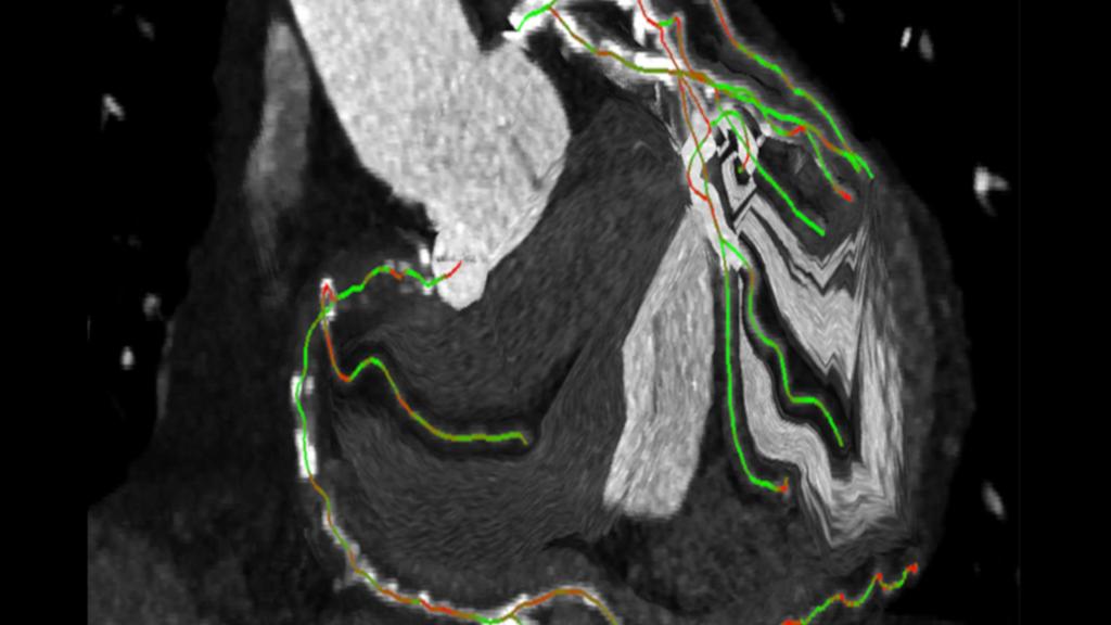 syngo CTO Guidance - Siemens Healthineers