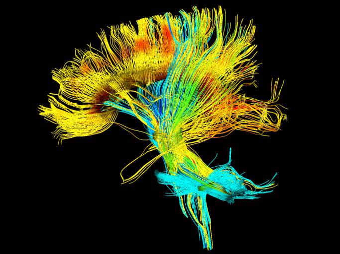 syngo&reg; DTI Tractography