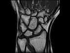 Siemens - MRI - MAGNETOM Sempra - Image - Orthopedics