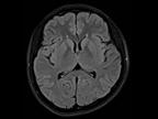 Siemens - MRI - MAGNETOM Sempra - Image - Neurology