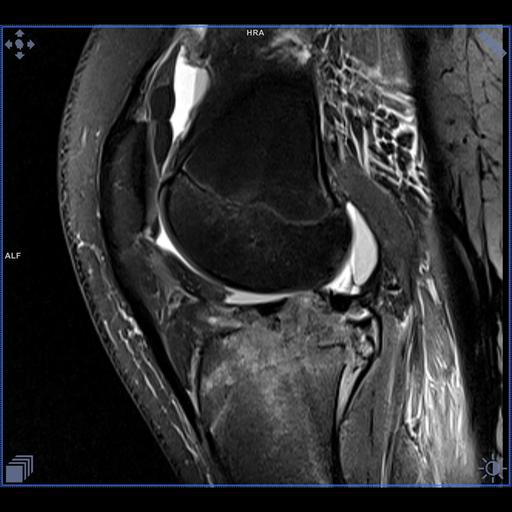 msk-phoenix-images-for-magnetom-sempra-1-5t-knee