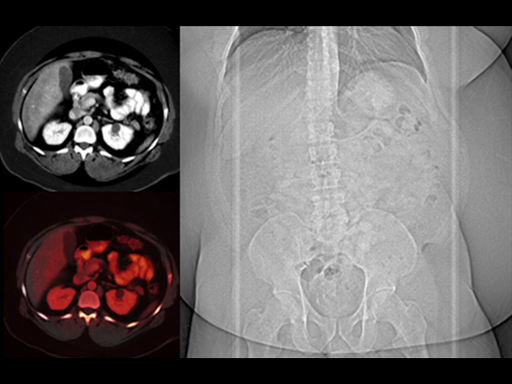 What is Dual Source Dual Energy? - Siemens Healthineers USA