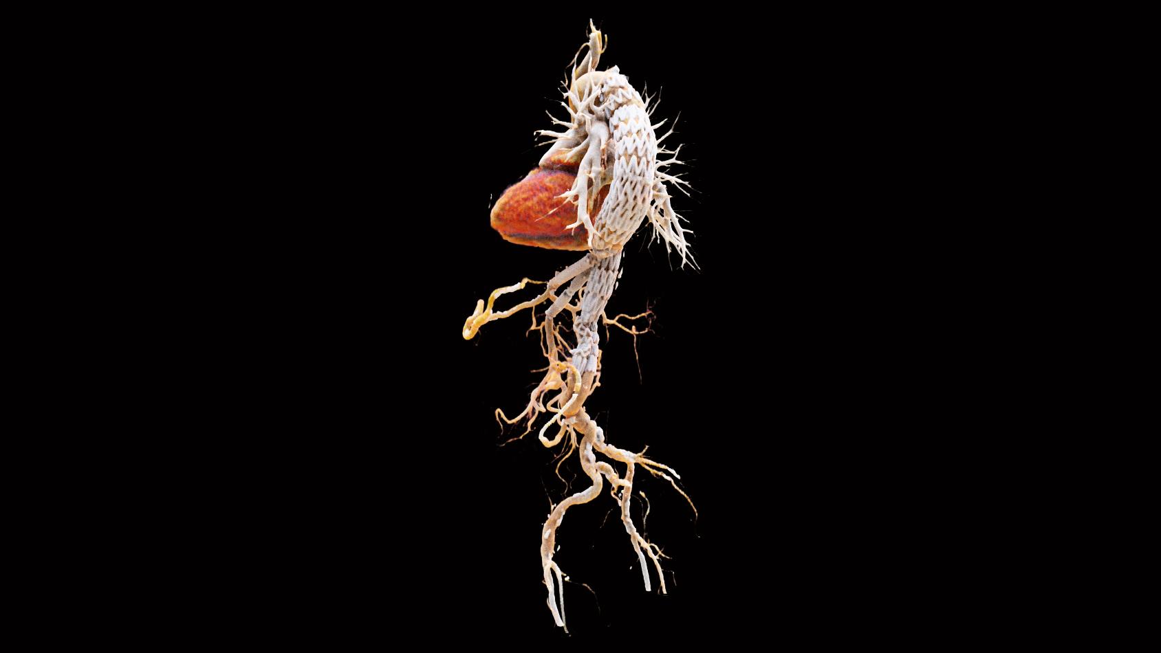 syngo.via Cinematic Rendering VRT - Siemens Healthineers USA