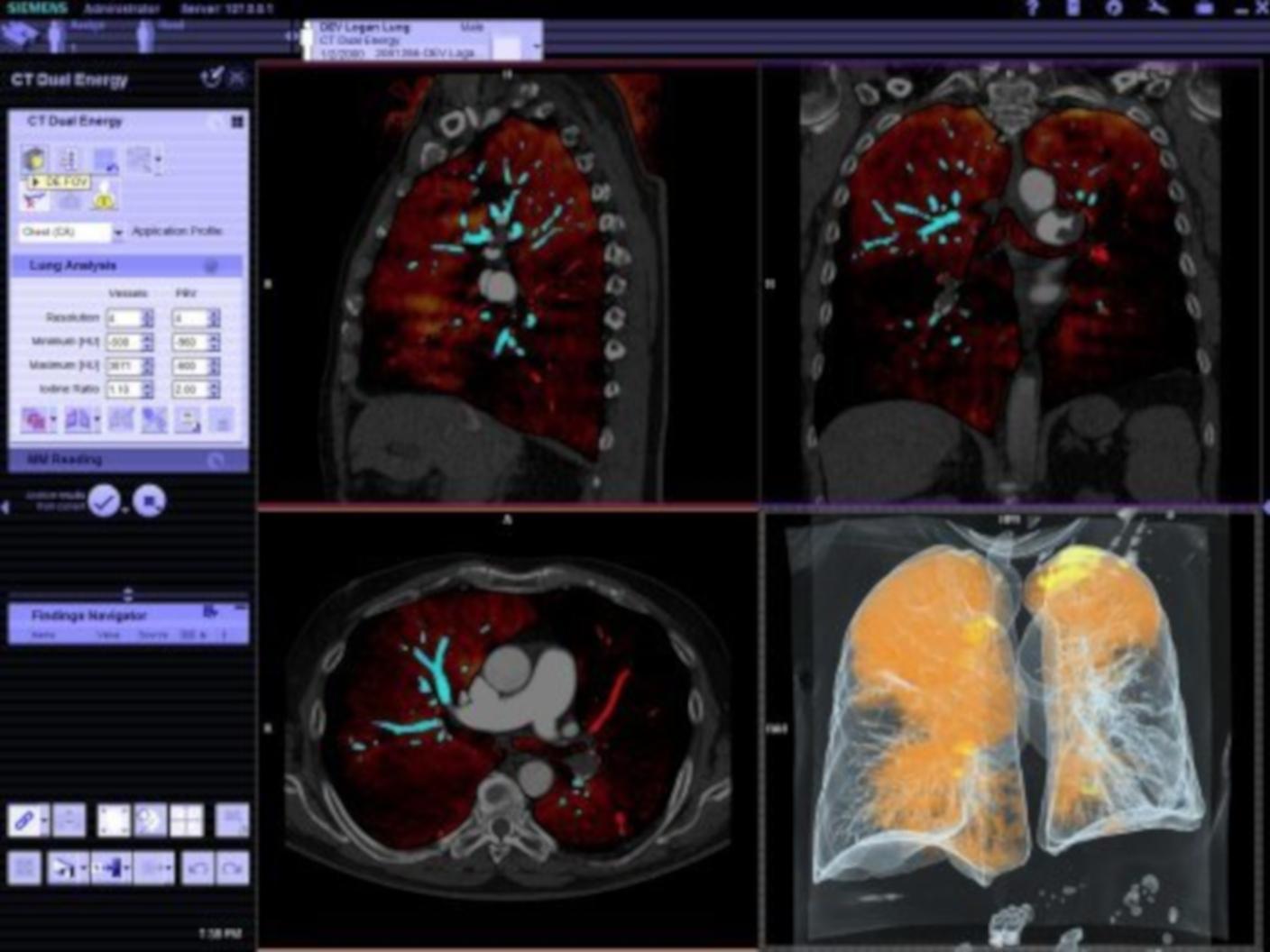 Options and upgrades for your computed tomography system