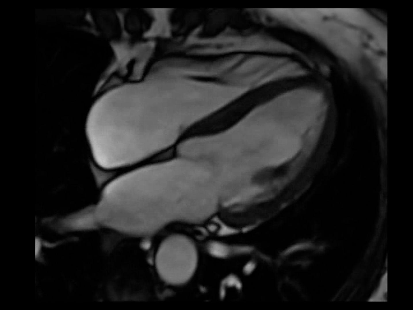 Cardiovascular MRI Efficient, reliable, ready.