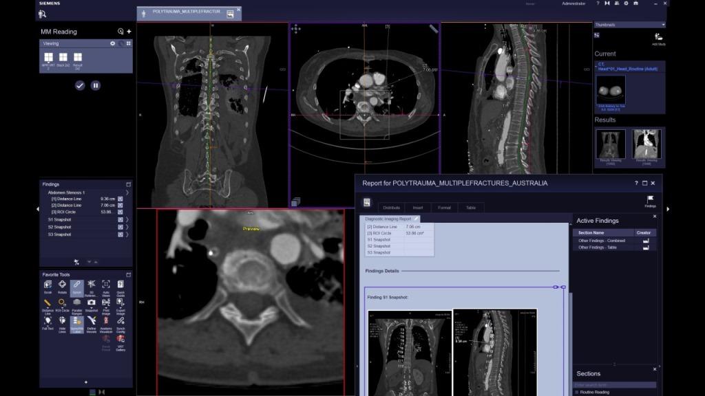 syngo.via enables both imaging reading and preparation of structured reporting.