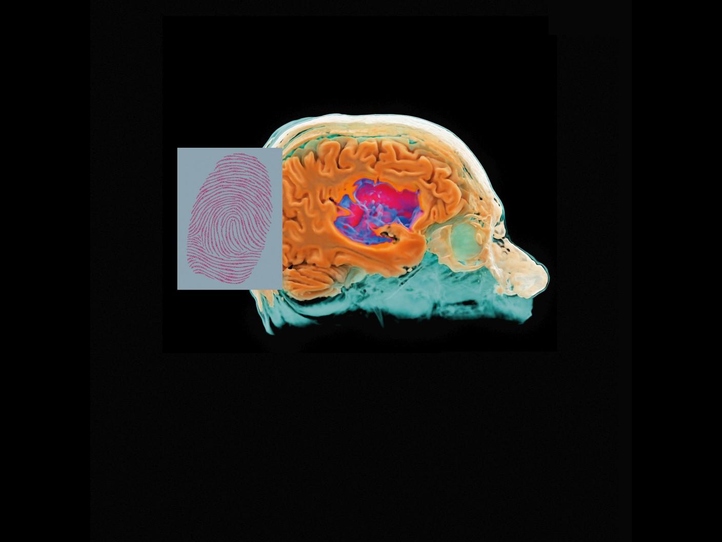 Magnetic Resonance Fingerprinting