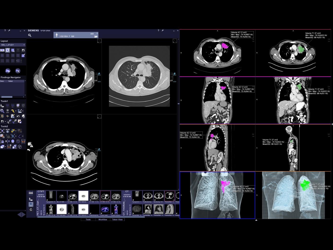 Modular syngo.plaza as a comprehensive solution – even for enterprise radiology