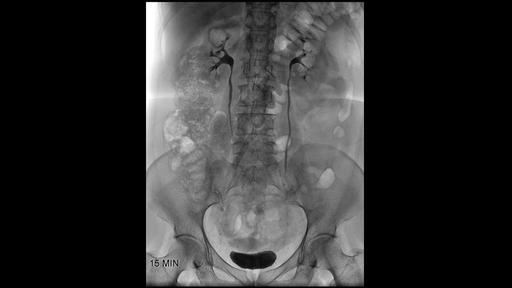 Urology Device Uroskop Omnia Max - Siemens Healthineers Schweiz