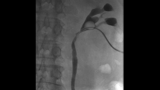 Urology Device Uroskop Omnia Max - Siemens Healthineers Schweiz