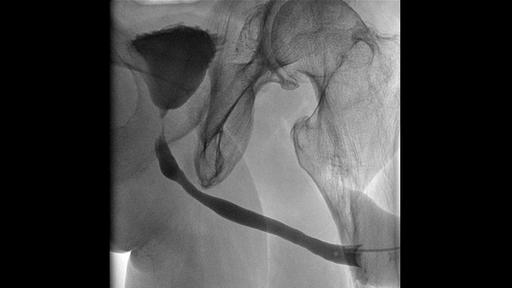 Urology Device Uroskop Omnia Max - Siemens Healthineers Schweiz