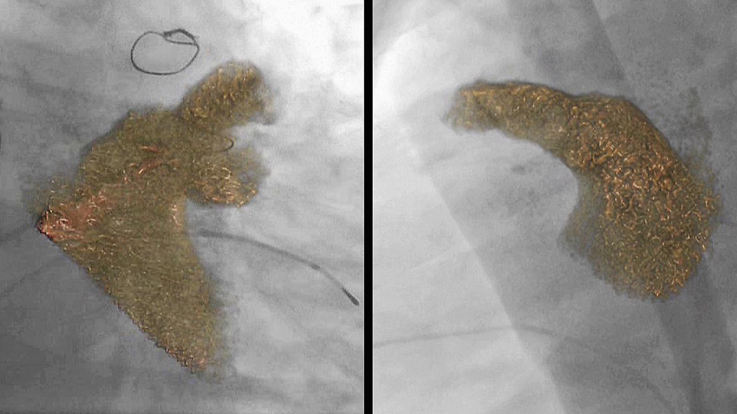 New Perspectives in Cardiology