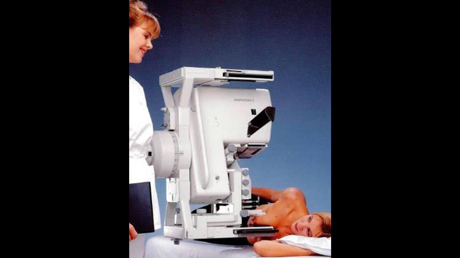 History of breast biopsy