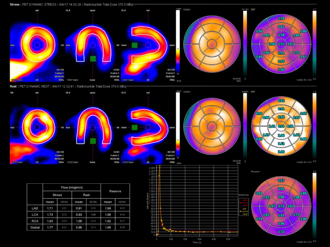 Absolute Flow and Flow Reserve Quantification: