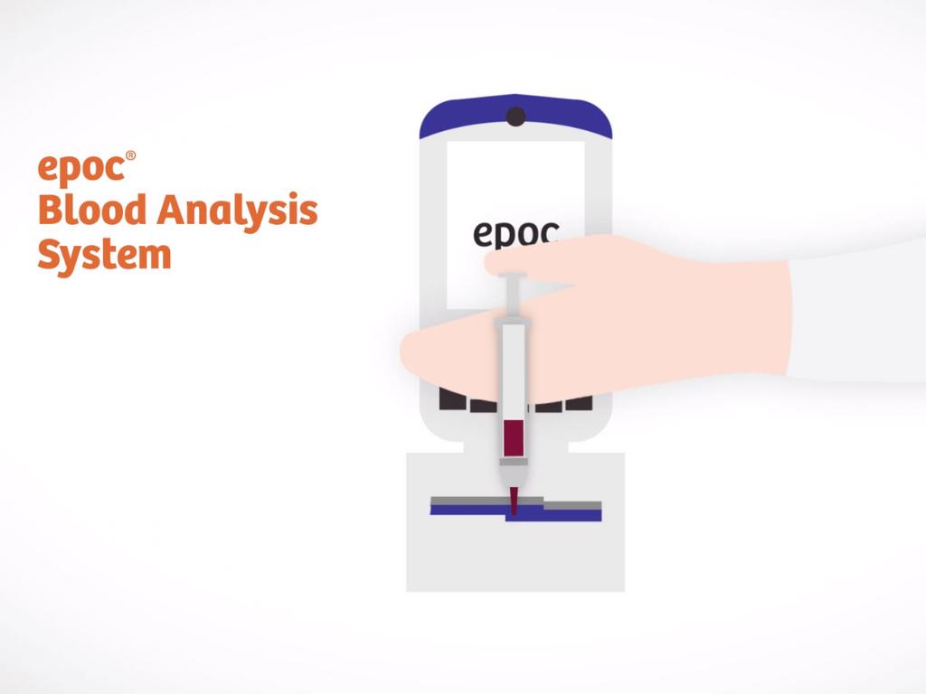 Improving the Patient Experience with Point-of-care Testing at ...
