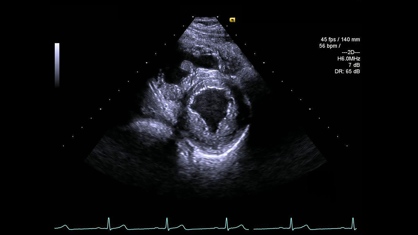 Mitral View Educational App - Siemens Healthineers