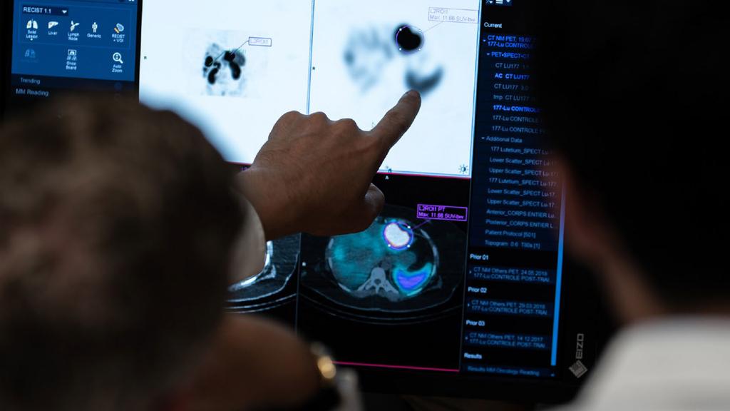 Reliable quantitative SPECT/CT with xSPECT Quant - Siemens Healthineers USA
