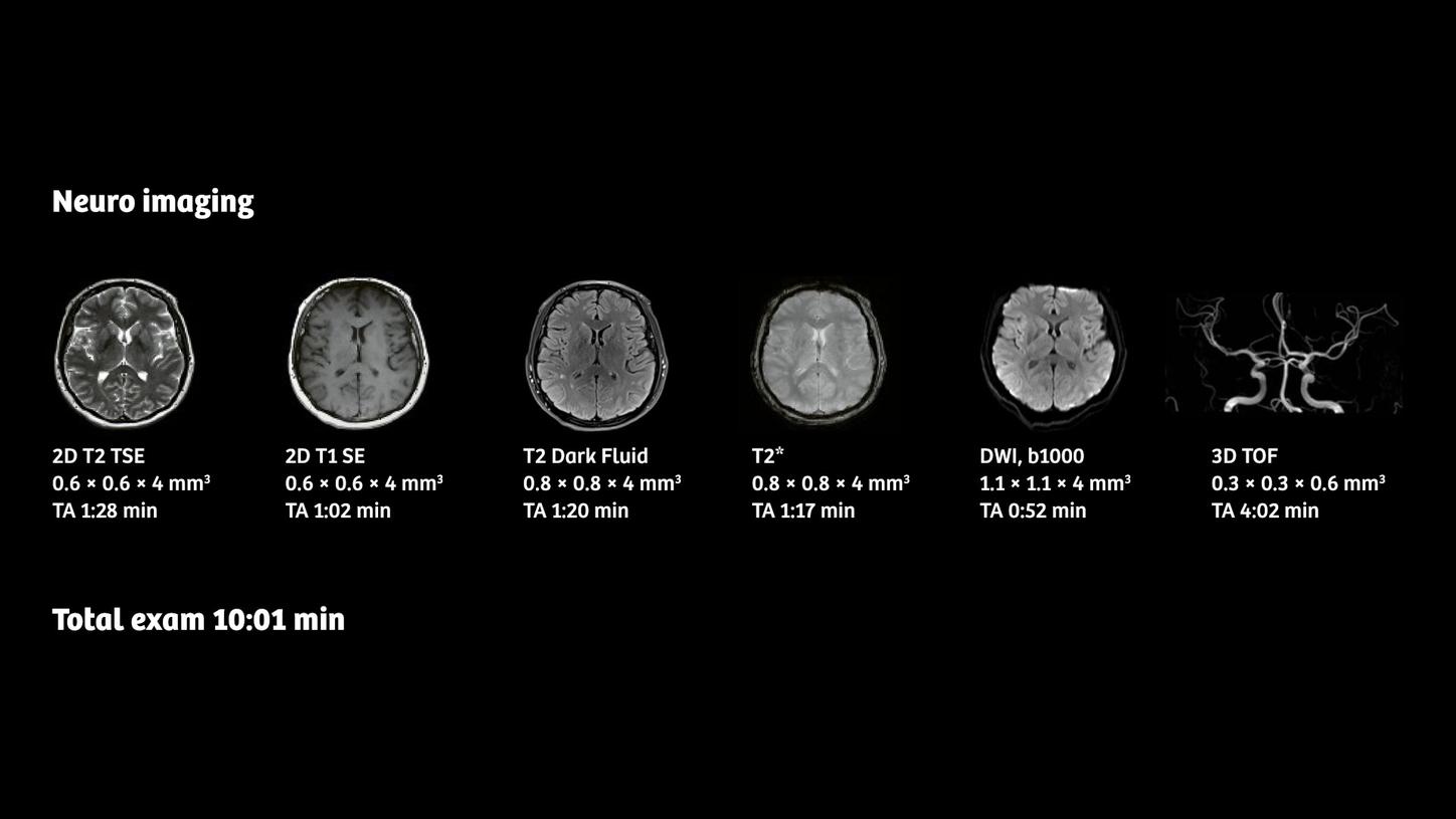 Siemens Healthineers - MRI - Turbo Suite Essential - Neuro imaging