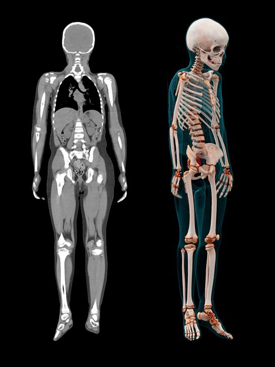 Imaging: A Tale of Two Cities - Siemens Healthineers USA