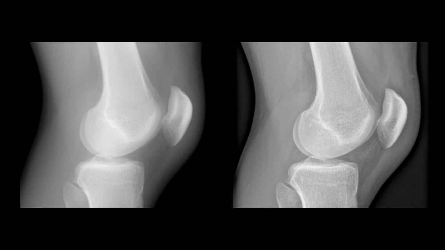 Optimale Bilddarstellung &ndash; f&uuml;r schnelle, sichere Diagnosen