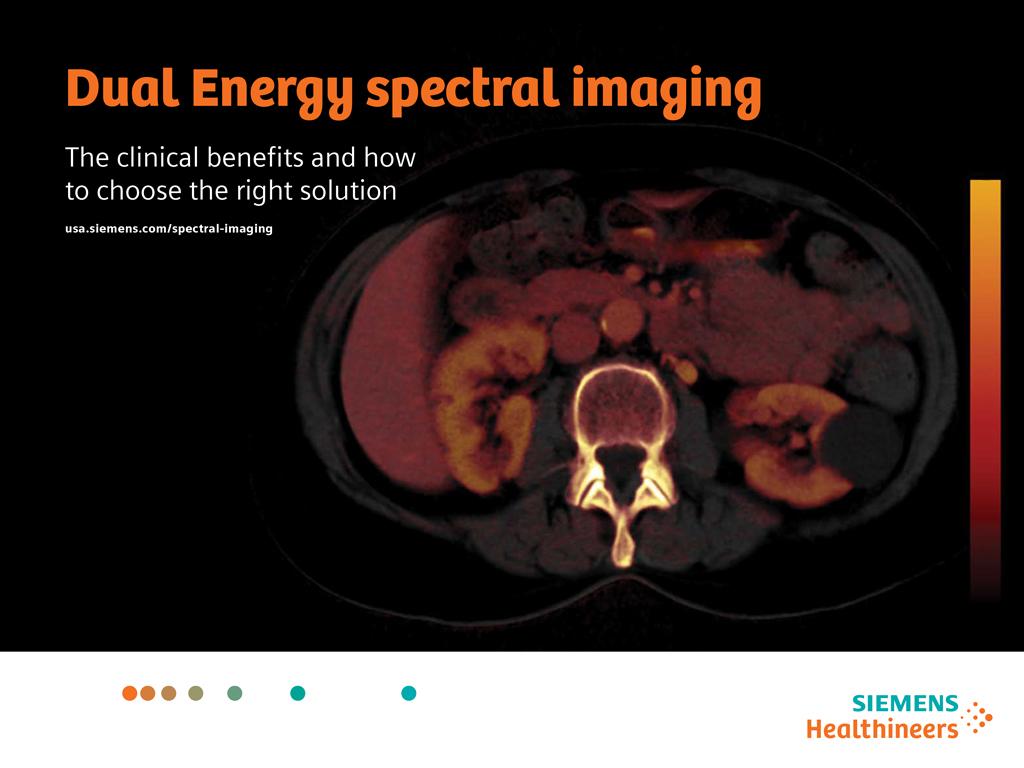 Guia de imagem espectral Dual Energy