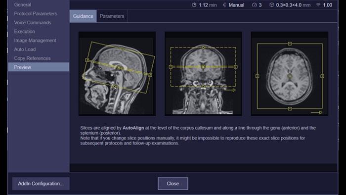 Siemens - MRI - RT Dot Engine - Image - Teaser