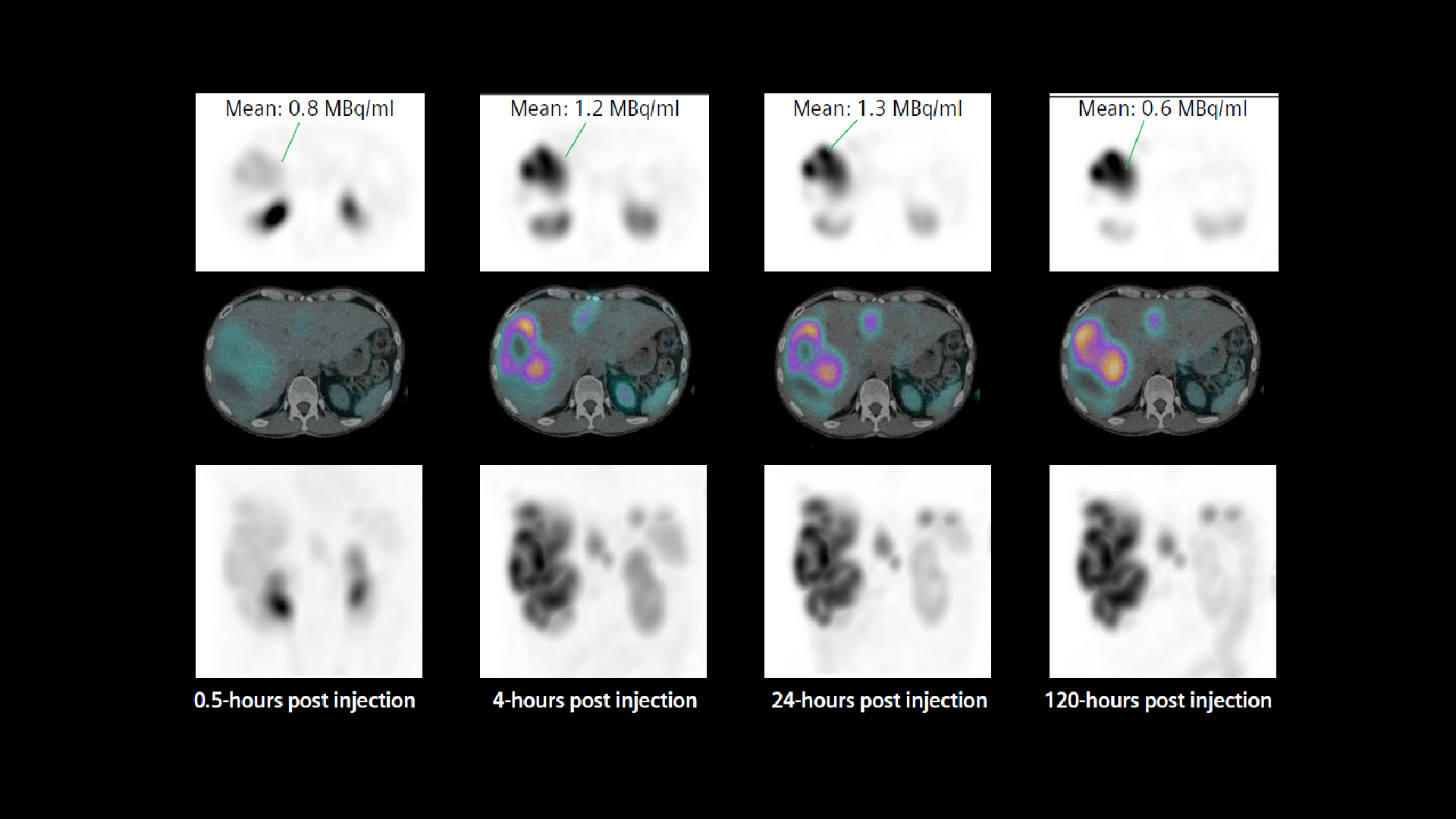 Evaluation of absorbed dose using sequential quantitative SPECT/CT ...