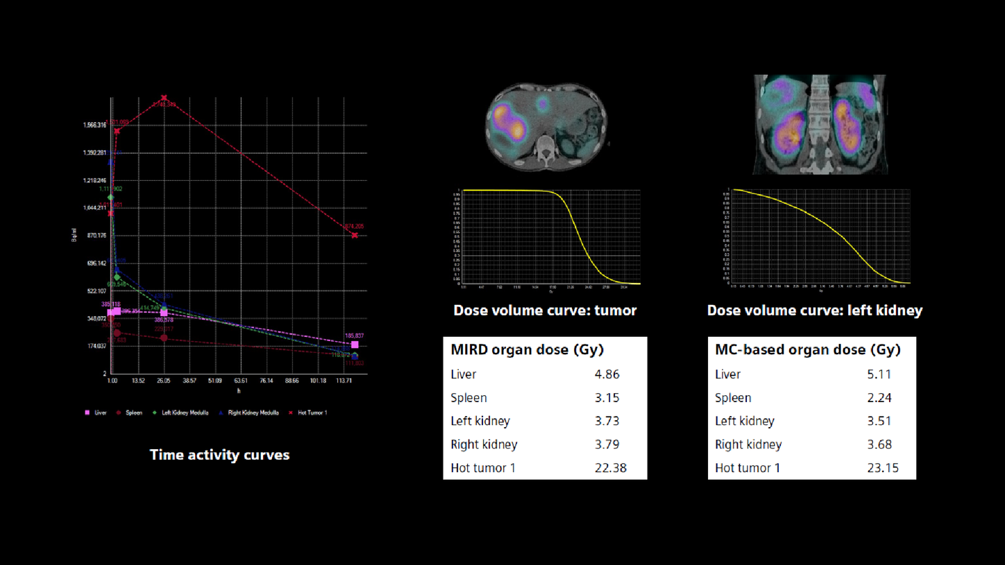 Time activity curves generated from VOIs drawn over the left and right kidney, whole liver, spleen, and 1 large liver metastases are aligned across multiple time points. The time activity curves yield retention times, which reflect an estimate of the number of disintegrations occurring within the VOI throughout the entire course of the tracer transit through the organ or tumor considering both the physical and biological half-life. Combining the time activity integrals with dose conversion factors yields the effective dose in Gy as shown in the dosimetry analysis tables. Dose volume curves for the tumor and left kidney are also depicted as representative curves demonstrating the overall high and uniform dose to the majority of the tumor volume. A bi-exponential curve fit method was used. MIRD organ dose tables show an overall dose of 3.73 Gy to the left kidney and 3.79 Gy to the right kidney, which may be considered low for such therapy administrations. One large tumor represented by the curve shows dose of 22.38 Gy, which represents a high tumor dose reflective of the potential for lasting suppression of tumor growth. A comparison of MIRD-based and voxel-based (Monte Carlo) dosimetry shows comparable values. However, dose volume histograms generated by voxel-based dosimetry gives a better understanding of the distribution of absorbed dose within a tumor and kidney as shown in the figur