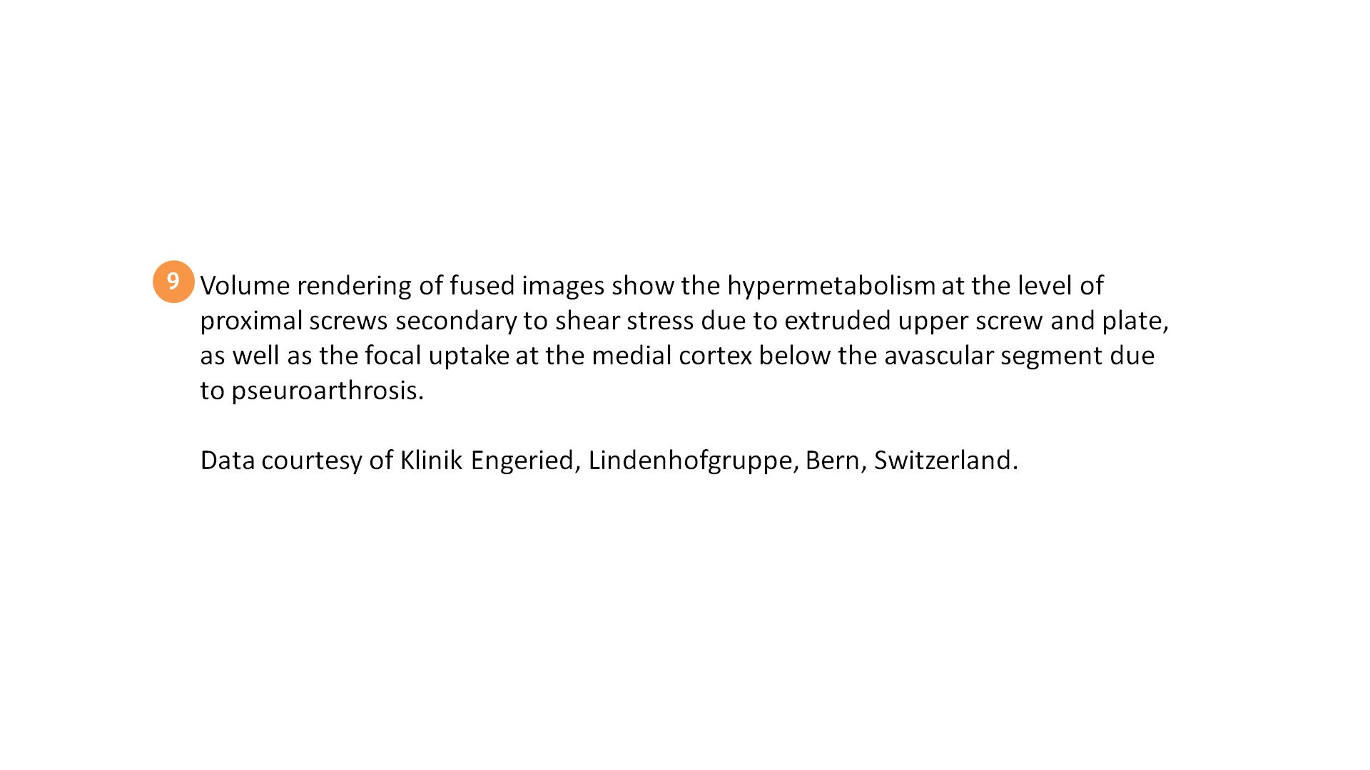 SPECT/CT delineation of proximal screw loosening and distal ...