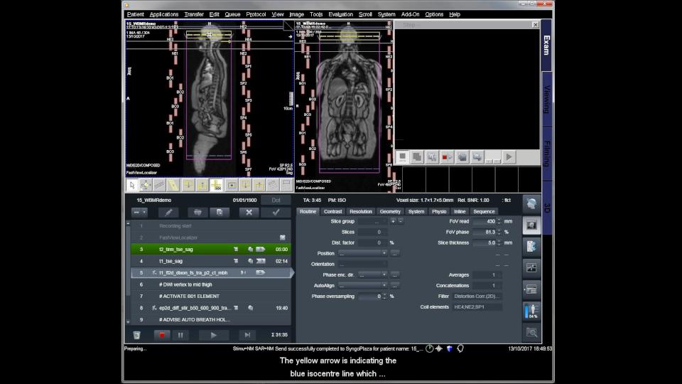 Just a glimpse of the video tutorial on whole-body MRI