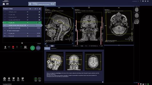 Aritificial Intelligence in Radiology