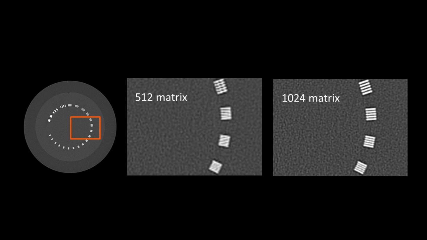 Role of matrix size in high-resolution CT imaging