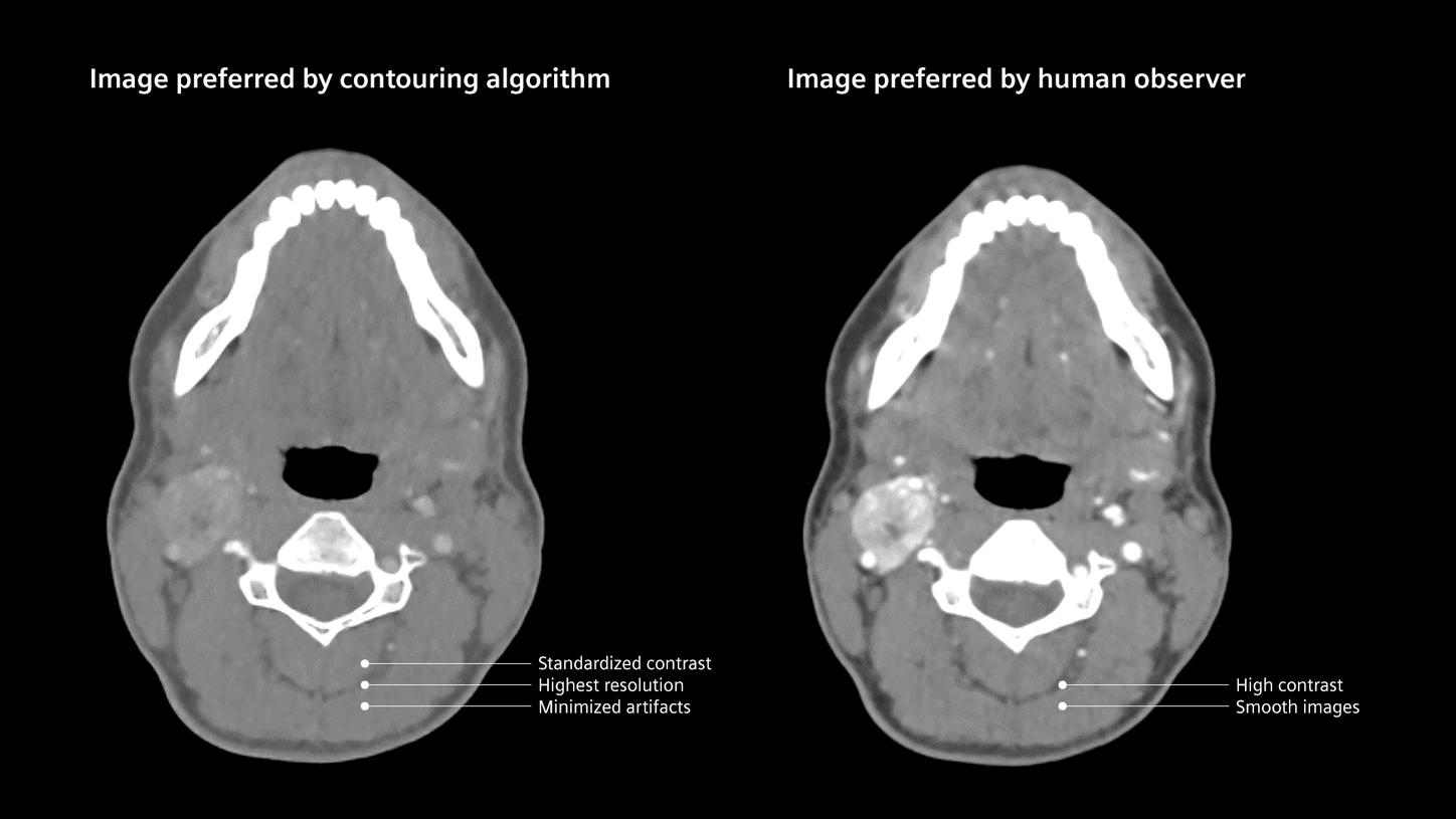 Different image requirements for CT simulation