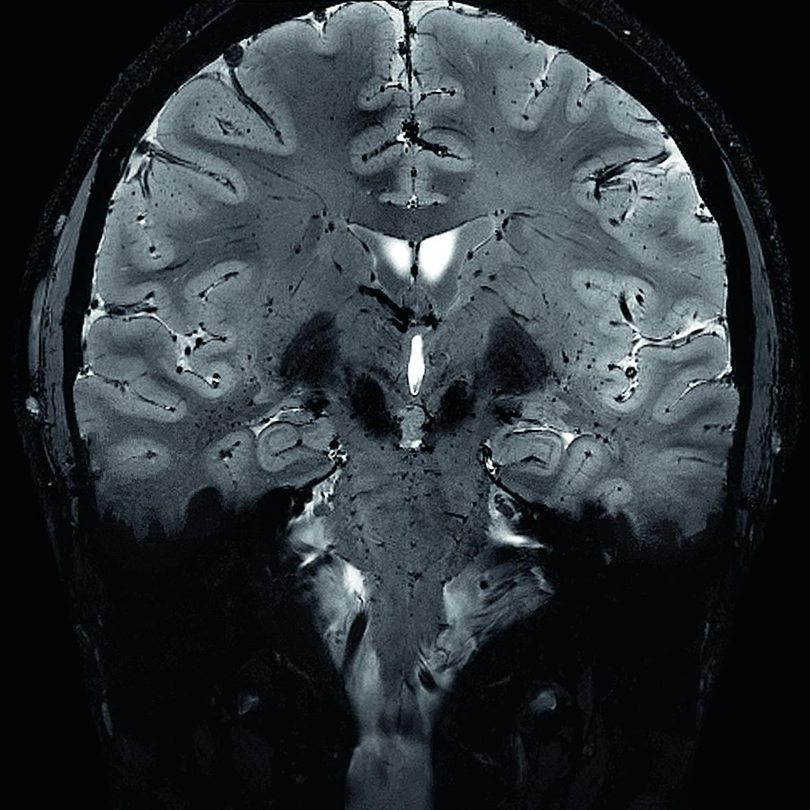 Expert on ultra-high field magnetic resonance imaging from Siemens ...