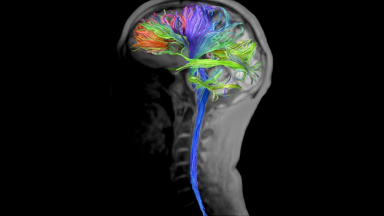 Resolve DTI Tractography