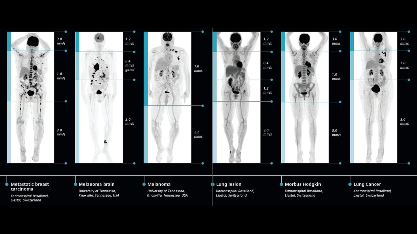 PET/CT scan protocols.