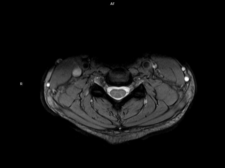 Transverse gre T2*-MAGNETOM Vida