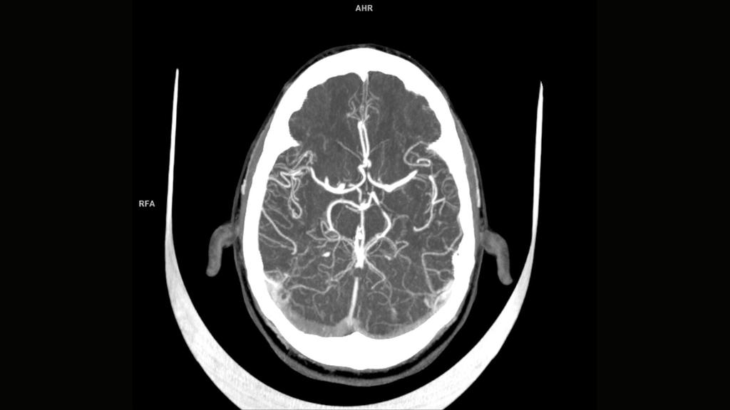 SOMATOM On.site Siemens Healthineers Deutschland