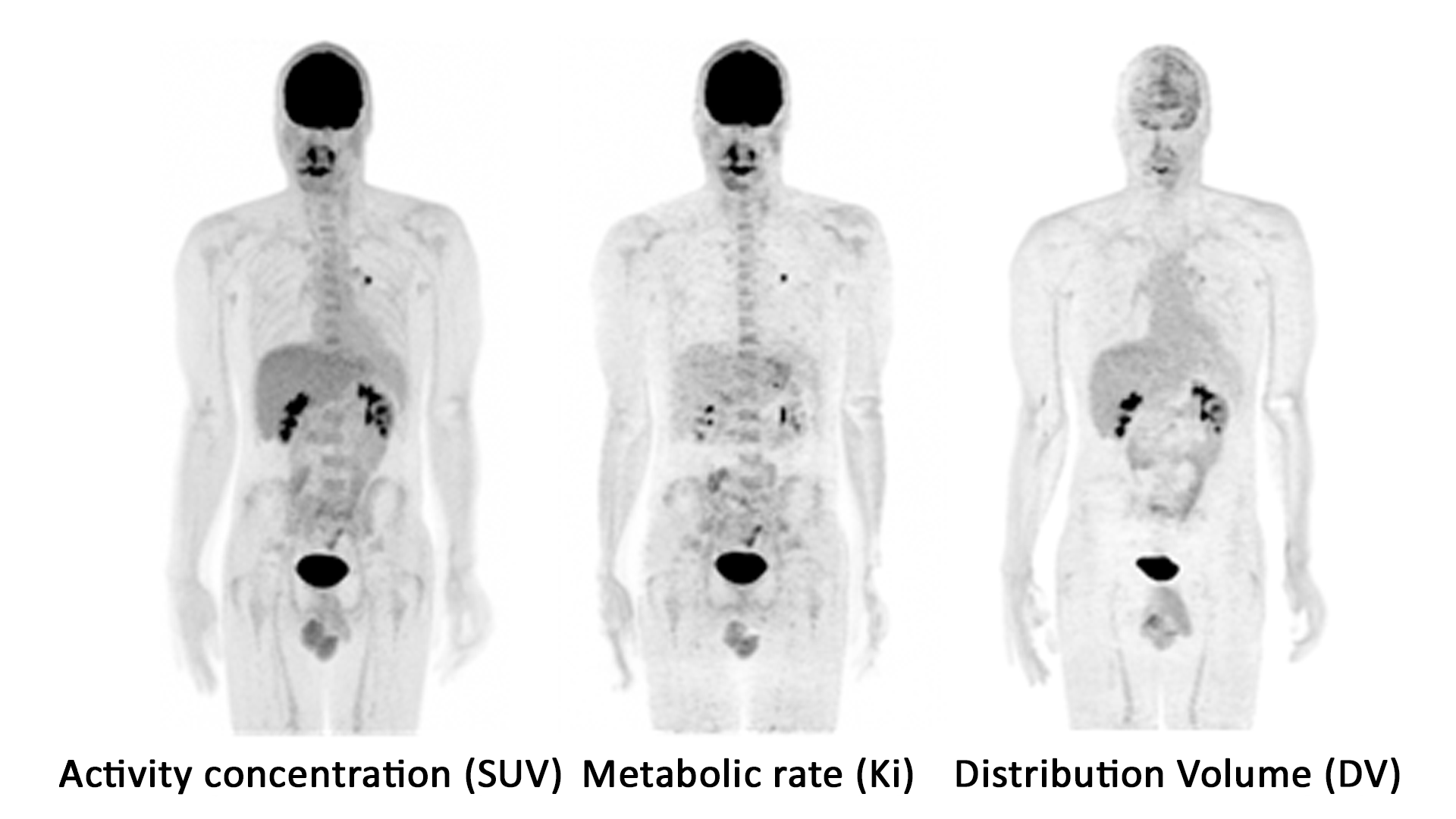 Multiparametric PET AI Siemens Healthineers USA