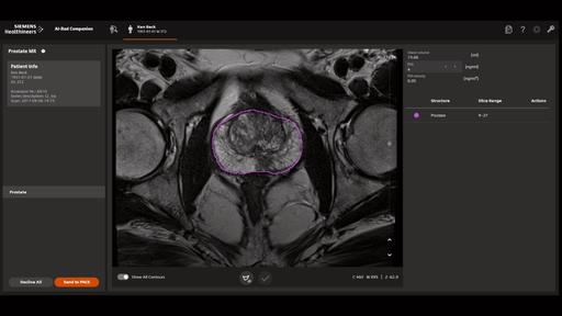 AI-Rad Companion Prostate MR - Siemens Healthineers Vietnam