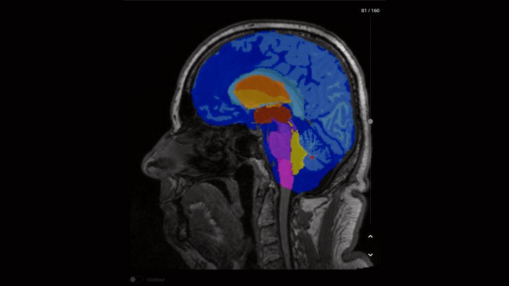 AI-Rad Companion Brain MR Etikett