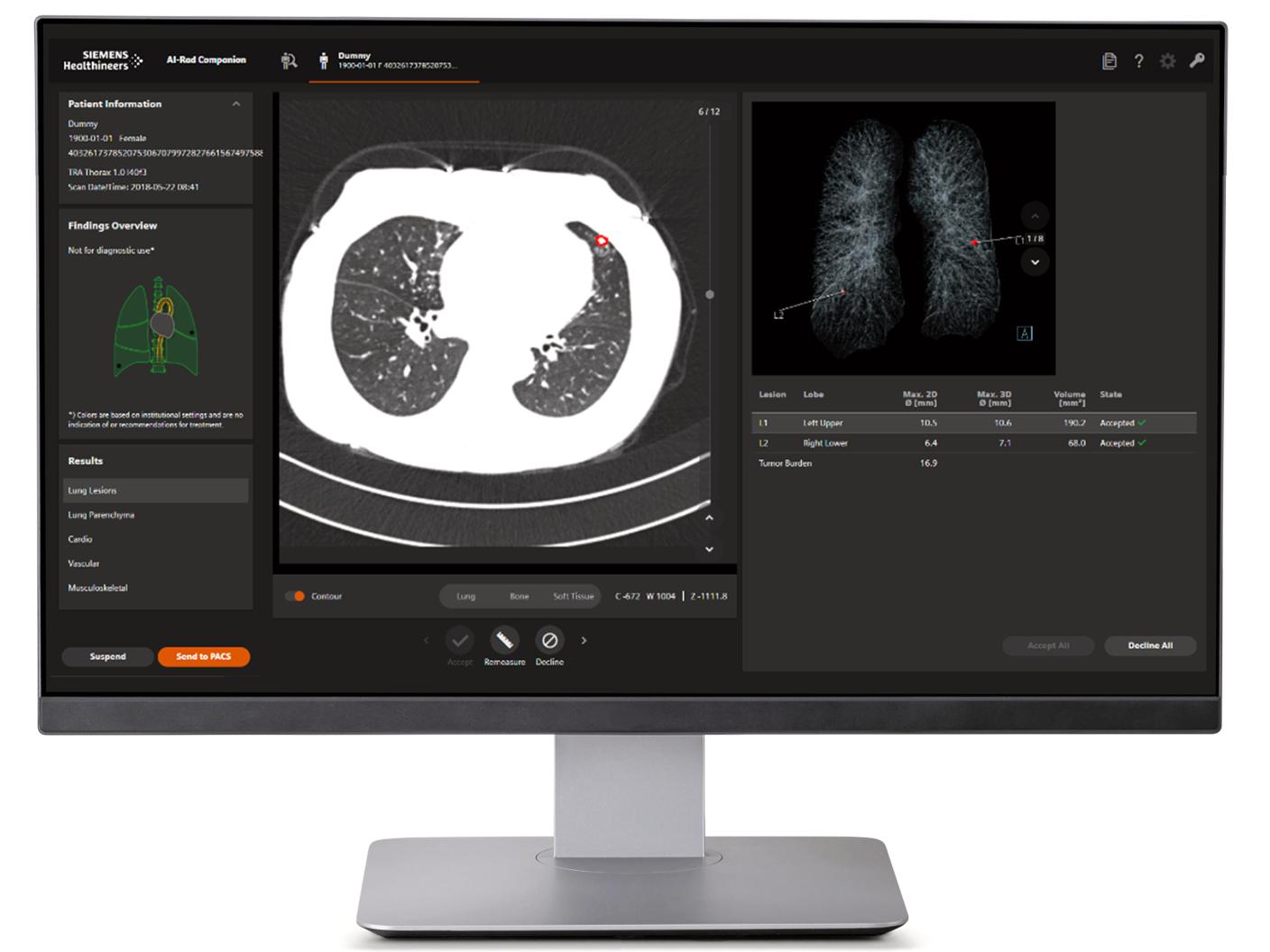 AI-Rad Companion – Integration von KI in Ihren Bildauswertungsworkflow